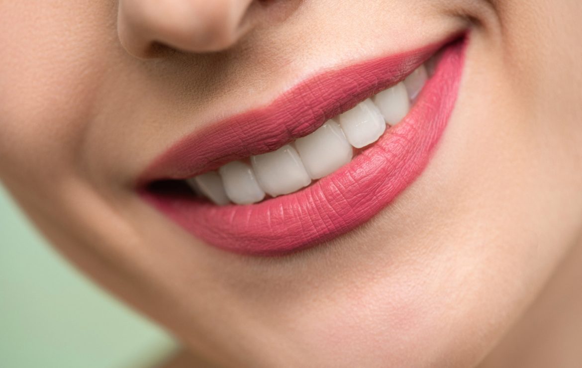 Are Porcelain Veneers Better than Dental Bonding?