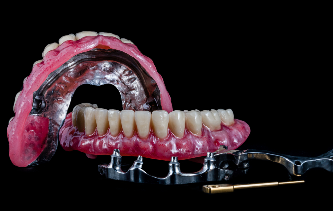 Transform Your Smile with All-on-4 Dental Implants