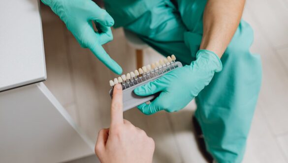 A Beautiful Smile with Cosmetic Dental Bonding