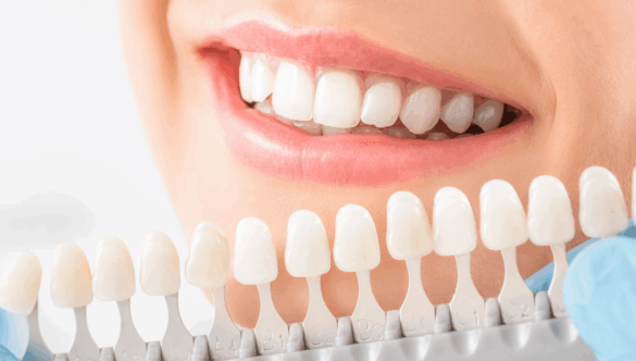 A New Smile with Cosmetic Dentistry